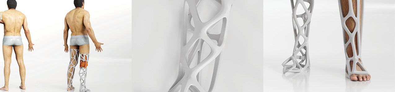 Digital renderings of the Xcel Limb prosthetic