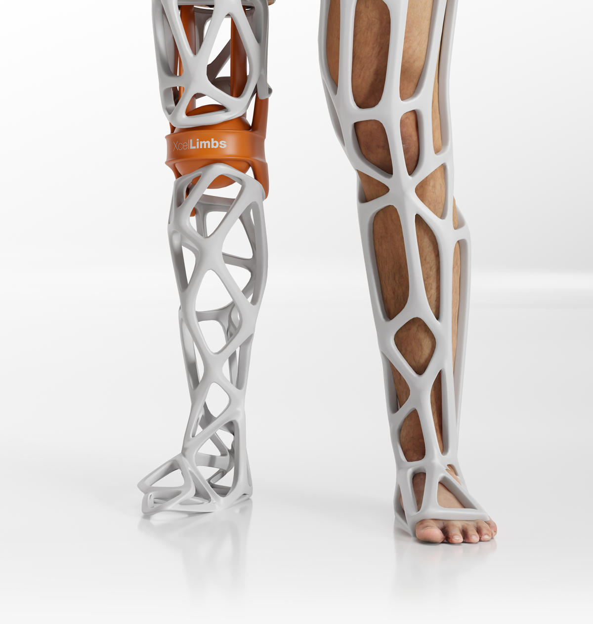 Digital rendering of prosthetic
