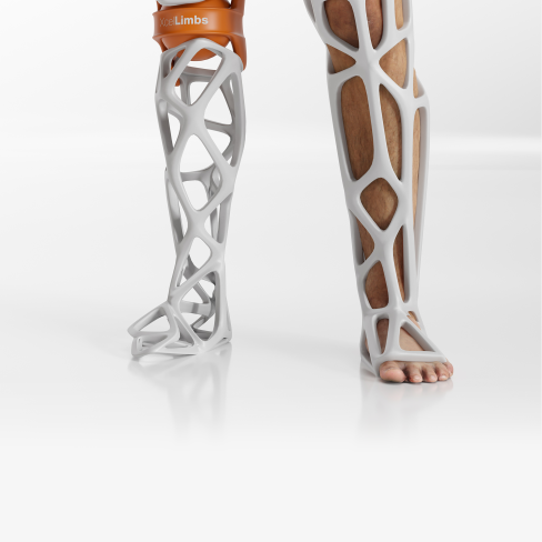 Digital rendering of the Xcel Limb prosthetic